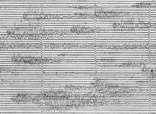 Harmonic tremor