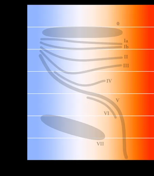Hypergiant