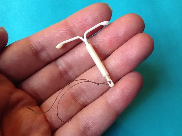 Intrauterine device