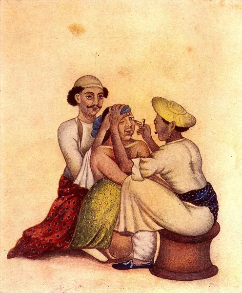 Couching (ophthalmology)