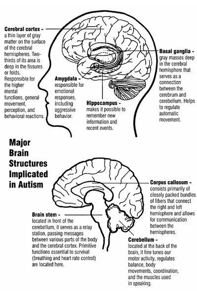 Causes of autism