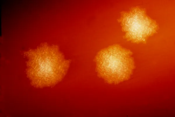 Clostridioides difficile