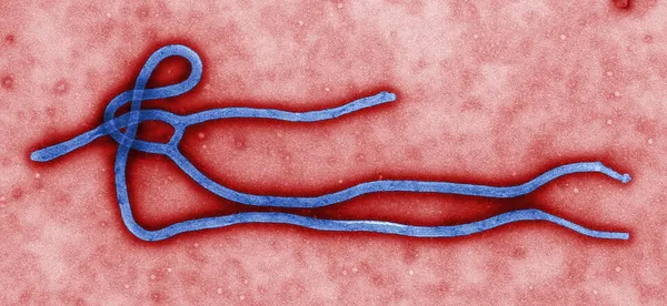 Ebola in the United Kingdom