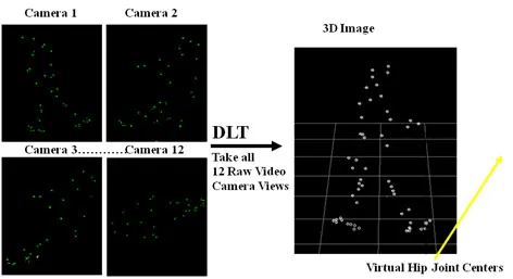 Gait analysis