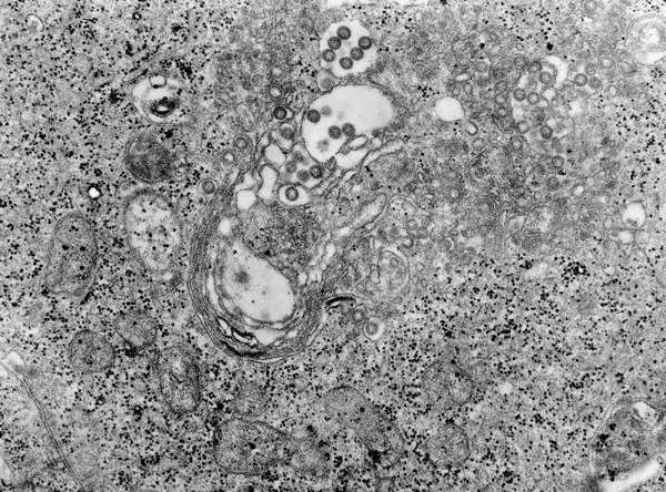 Arbovirus