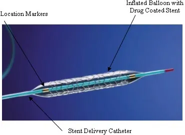 Drug-eluting stent