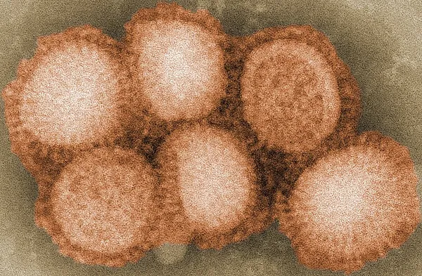 1977 Russian flu