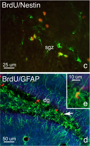 Adult neurogenesis