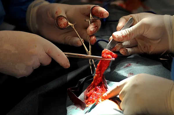 Dermatologic surgical procedure