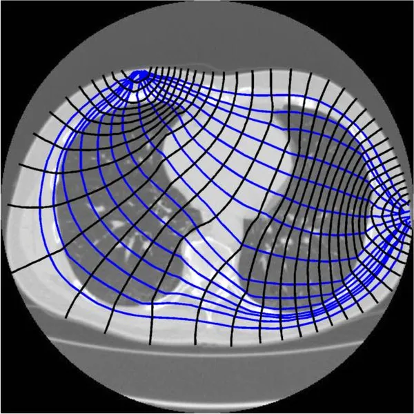 Electrical impedance tomography