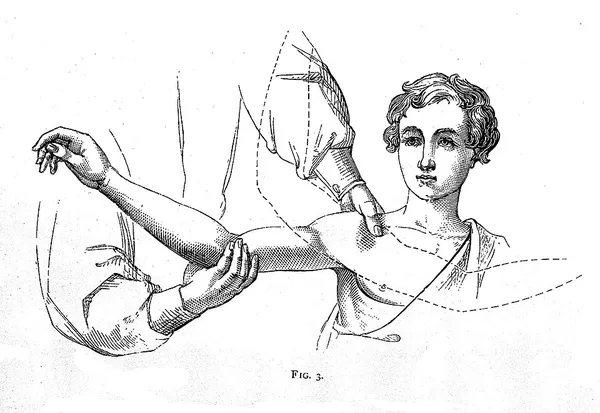 Bone-setting